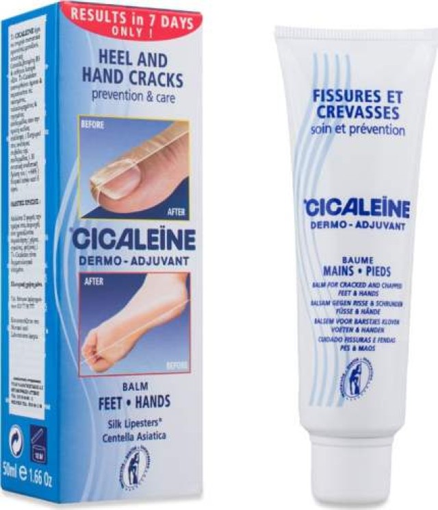 Akilene Cicaleine 50ml (Κρέμα για Ξηρές, Σκασμένες & Ανοιγμένες Φτέρνες)